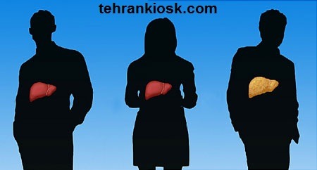 ورزش مناسب برای درمان کبد چرب و معرفی تمرین های مناسب