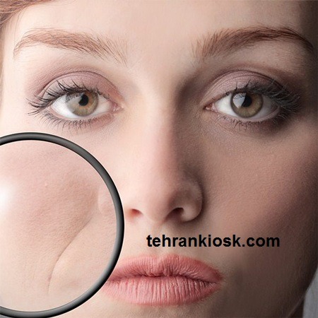 برطرف کردن خط لبخند در منزل و بررسی عوامل به جود آمدن آن در صورت