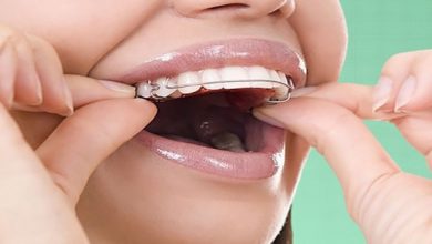 انواع ارتودنسی و هر آنچه که باید درباره ارتودنسی متحرک بدانید ارتودنسی متحرک