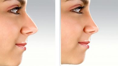 روشی آسان و کاملا موثر برای کوچک کردن بینی با زنجبیل! روش خانگی کوچک کردن بینی