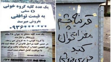فروش اعضای بدن به دلیل فقر زیاد فروش گوشت اعضا بدن