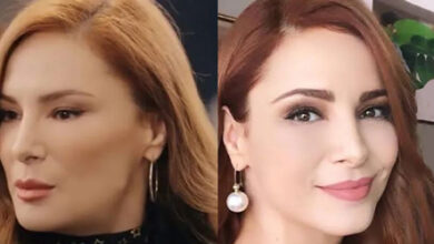 تغییر چهره عجیب مینه توگای بازیگر مشهور ترکی تغییرات چهره مینه توگای