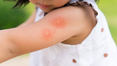 به چه علت نباید جای نیش پشه را خاروند ؟ از بین بردن اثر نیش حشره